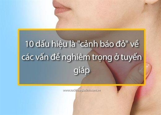 Nhà cái cá cược cá độ uy tín Nổ hũ, Bắn Cá và Game Bài Cwin.com-X6-hong-xe